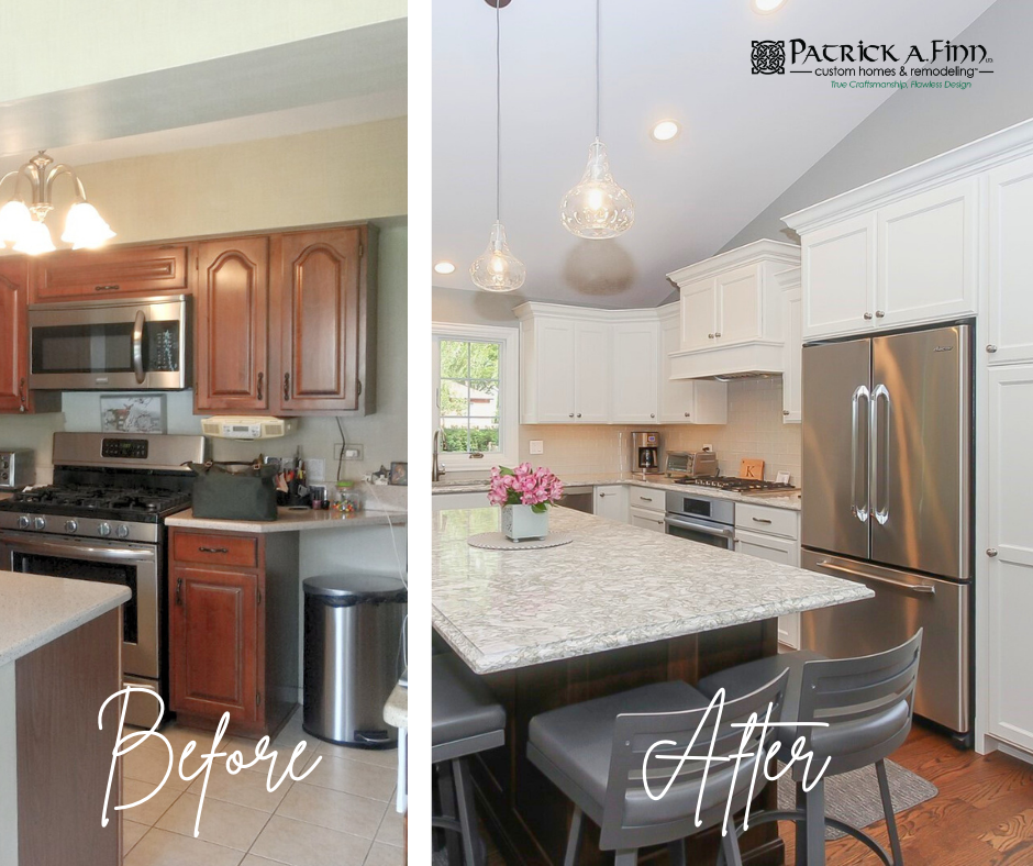 transitional-before-after
